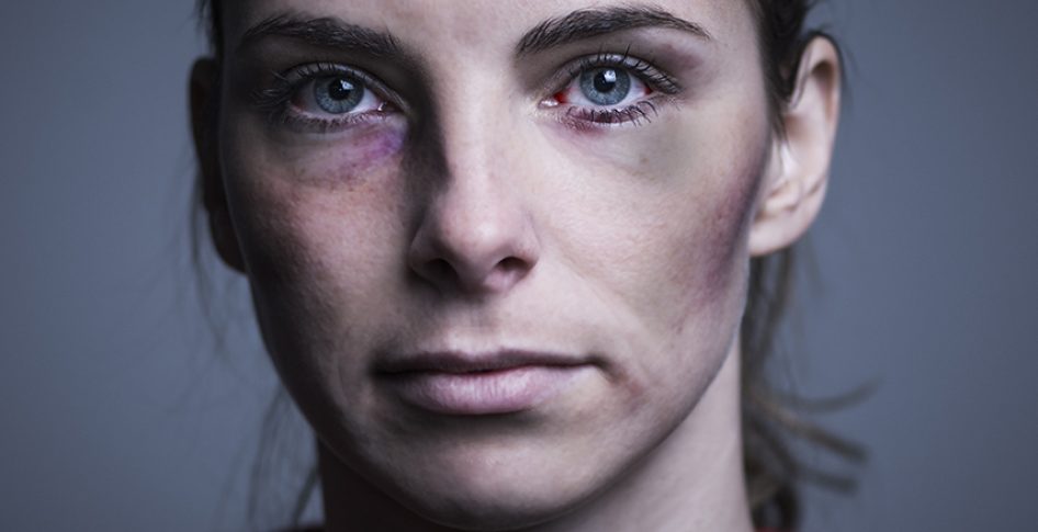 If you don't want to look like I beat you with a stick read this