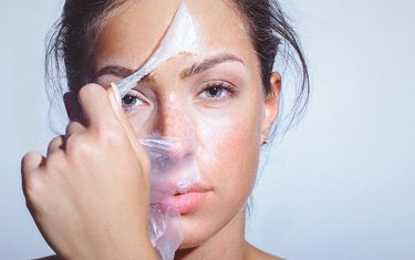 How to Prevent and Get Rid of Blackheads